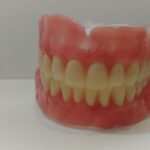 protese-total-imediata--01