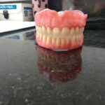 protese-total-imediata-02